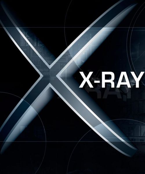 X-Ray SDK