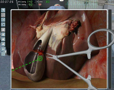 второй скриншот из Chirurgie-Simulator 2011 / Симулятор хирурга 2011